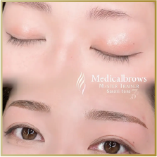 症例1ビフォーアフター