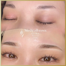 症例2ビフォーアフター