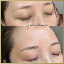 症例3ビフォーアフター