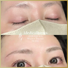 症例4ビフォーアフター