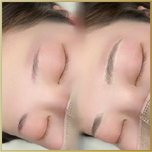 症例5ビフォーアフター